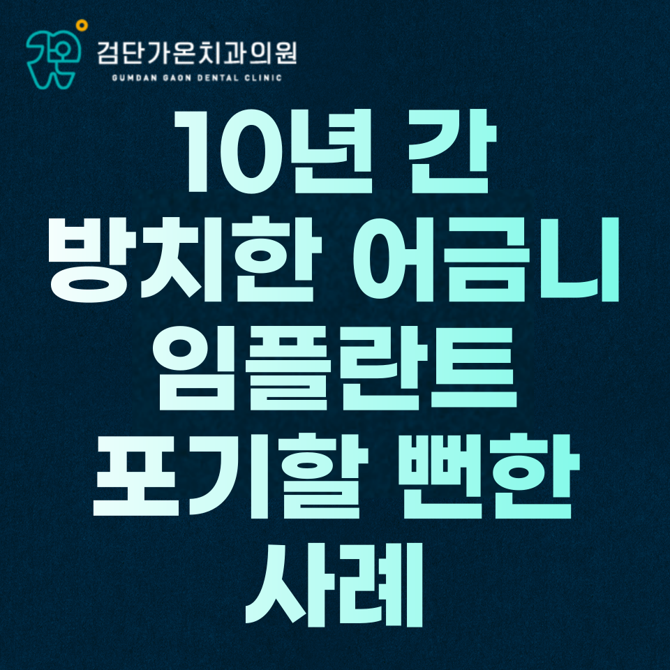 인천 검단 임플란트, 10년 간 방치한 어금니 임플란트 포기할 뻔한 사례