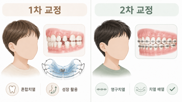 1차 vs 2차 교정 개념 비교
